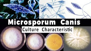 Microsporum Canis Culture Characteristic [upl. by Enoval]