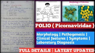 polio  poliomyelitis in hindi  polio vaccination  polio disease in hindi  polio in hindi [upl. by Epoh]