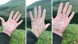 Giant Swarm Of Midges Stick To Hand In Scotland [upl. by Nodababus]