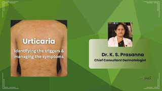 Urticaria  Identifying triggers amp managing symptoms  Integrated Medicine for Skin Diseases  IAD [upl. by Nojad]