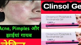 Clinsol gel review  Clinsol gel  Best pimple gel  पिंपल्स के लिए सबसे बेस्ट जेल  क्लिंसोल जेल [upl. by Fuhrman]