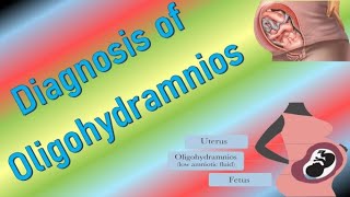 Diagnosis of Oligohydramnios by Ultrasound in Pregnancy [upl. by Yelrahs]