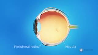 What is retinopathy of prematurity ROP [upl. by Skier]