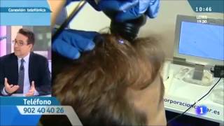 ¿Cabello fino o alopecia androgenética [upl. by Waring]