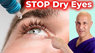 Soothe and Heal DRY EYES Naturally Dr Mandell [upl. by Noicpesnoc885]