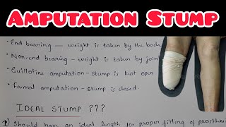 Amputation Stump  Ideal Amputation Stump NOTES  Orthopaedics  Levels Of Amputation [upl. by Einahpats]