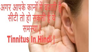 ringing in ears  tinnitus Treatment in hindi  Causes and treatment factsandmeinhindi [upl. by Gabey789]