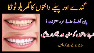 How To Whiten Teeth At Home  Easiest Teeth Whitening Remedy 😱 [upl. by Ellene]