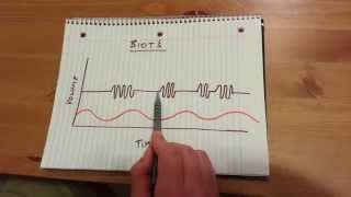 Biots Respiration [upl. by Vasiliki]