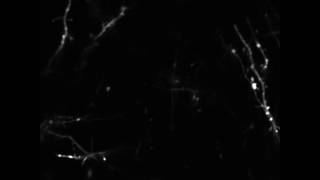 Dendrites and dendritic spines in the mouse cortex [upl. by Ardyth204]