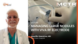 Dr Deandrea Managing Large Nodules with VIVA RF Electrode [upl. by Atnauqahs]