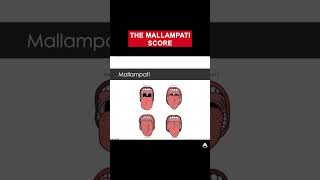 The Mallampati Score  shorts anaesthetics cico [upl. by Ylla]