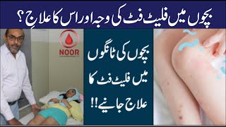 Growing Pain In Kids Treatment  Bacho Ki Tango Men flat foot ki waja or iska ilaj Leg Pain Solution [upl. by Nuris]