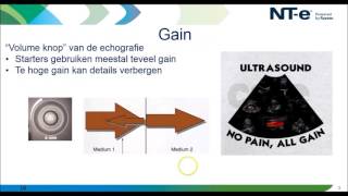 Webinar knoppologie knobology in de echografie [upl. by Ora748]