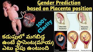 Baby Gender Prediction by Placenta II Placenta positions during pregnancyII Posterior means baby boy [upl. by Teragramyram535]