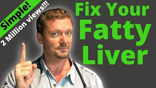 FATTY LIVER How to Fix It Better than Any Pill 2024 [upl. by Dnalloh]