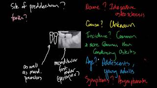 Idiopathic osteosclerosis [upl. by Philips538]