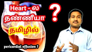 Pericardial Effusion in tamil  Heart Problem in tamil  ECG ECHO in tamil [upl. by Ykciv]