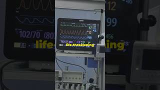 Understanding Heart Arrhythmia Quick Guide [upl. by Ashraf285]