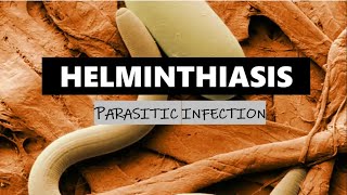 HELMINTHIASIS [upl. by Orvan]