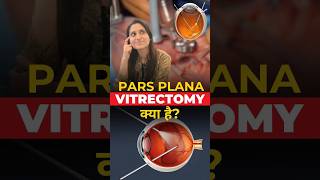 What is Pars plana Vitrectomy [upl. by Ariamoy]