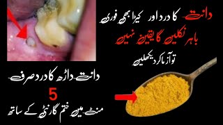 Tooth pain  Dant k Dard ka ilag [upl. by Nahsed707]