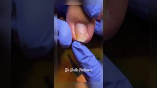 Nails satisfying pedicure shorts nails pedicure satisfying [upl. by Weisbrodt455]