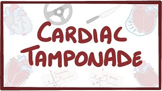 Cardiac tamponade  causes symptoms diagnosis treatment pathology [upl. by Horowitz207]