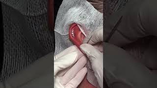 TRIGGER NEEDLE Wedding Inspired Ear Piercings using Base Laboratories Hypochlorous Acid Spay [upl. by Lek171]