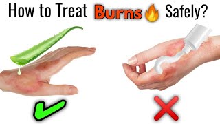 How to Treat Burn at Home  Types of Burns [upl. by Noswad]