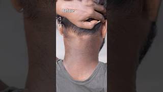 Remove Neck Darkness At Home In 5min  Neck Cleaning Tips  Dark Neck Remove Home Remedies shorts [upl. by Novel]