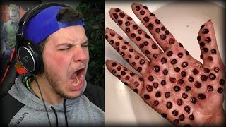 ULTIMATE TRYPOPHOBIA TEST WARNING GROSS [upl. by Poland]