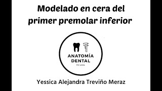 MODELADO EN CERA DEL PRIMER PREMOLAR INFERIOR [upl. by Waechter]