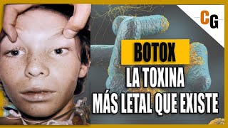 Toxina Botulínica  Botox LA TOXINA mas PODEROSA del Mundo  Fisiopatología y Síntomas del Botulismo [upl. by Enitsugua663]