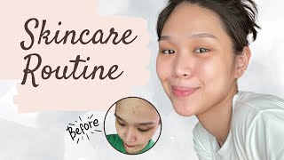 MY SKIN JOURNEY  UPDATED SKINCARE ROUTINE 2024 highly requested  lovewendyxdiane [upl. by Landsman]