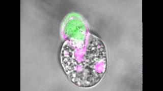 An amoeba eating a human cell [upl. by Atikel]