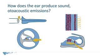 Otoacoustic emissions OAE  Introduction for newborn hearing screening programs [upl. by Adey]