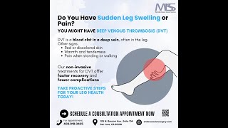 Your Leg Swelling Might be Deep Venous Thrombosis [upl. by Rases49]