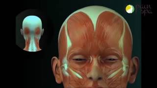 Botox Injection Treatment For Migraine Headaches [upl. by Haisoj]