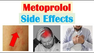 Metoprolol amp Beta Blockers Side Effects amp Why They Occur [upl. by Christianity664]