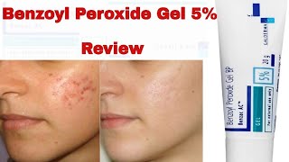 Benzoyl Peroxide Gel For Acne Treatment Review In Hindi 2019 [upl. by Gretchen]