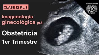 121  Imagen en Obstetricia 1er Trimestre [upl. by Shieh]