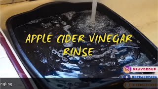 How To Prevent Itchy Braids ACV Rinse [upl. by Treat]