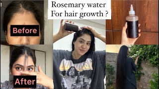 Best Lost hair regrowth remedy 😱 visible results with proof [upl. by Ibbob]