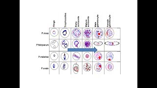 Various stages of Malarial Parasites in PBS [upl. by Arakal]