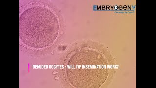 Can Denuded Oocytes be Fertilized by IVF  Will Conventional IVF work on Denuded Oocytes [upl. by Henry]