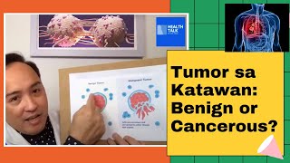 The differences between a benign non cancerous and a malignant cancerous tumor [upl. by Boot]