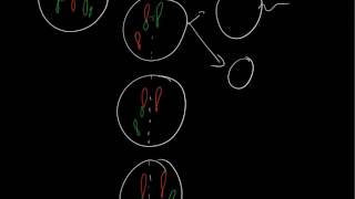 Robertsonian translocation 21q14q [upl. by Oliver]