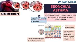 Signs and symptoms of bronchial asthma in brief for dentists [upl. by Yerag]