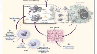 Managing Single Organ SLEITP [upl. by Rosio]